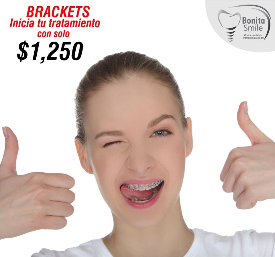 Comienza tu tratamiento de #Brackets con solo $1250